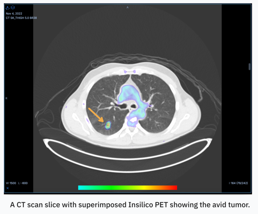 Oxford spinout RADiCAIT makes use of AI to make diagnostic imaging extra reasonably priced and accessible — catch it at TechCrunch Disrupt 2025 Oxford spinout RADiCAIT uses AI to make diagnostic imaging more affordable and accessible — catch it at TechCrunch Disrupt 2025