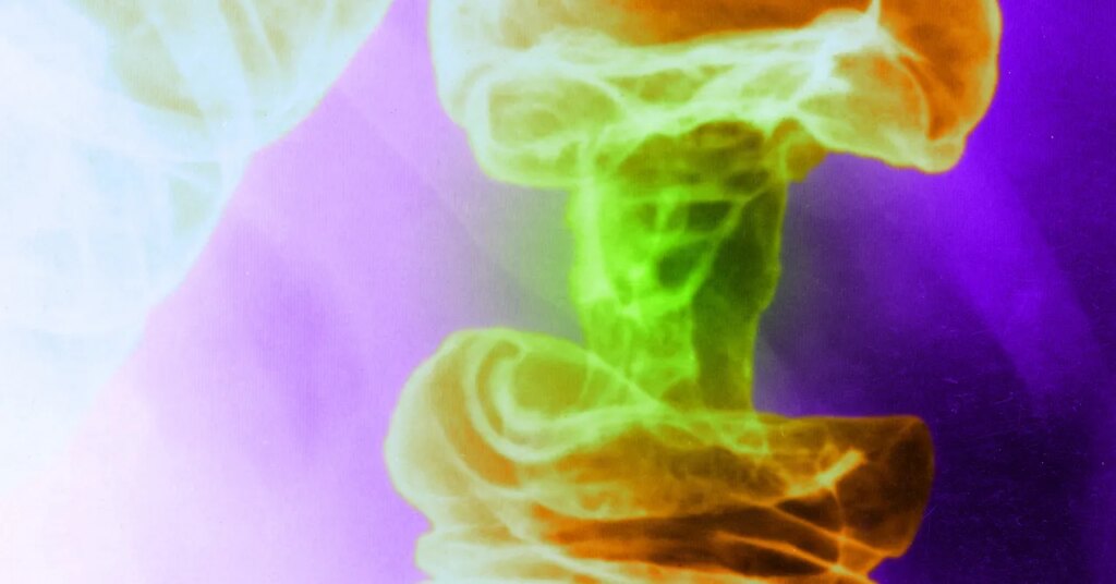 A New Gentle-Based mostly Most cancers Remedy Kills Tumor Cells and Spares Wholesome Ones A New Light-Based Cancer Treatment Kills Tumor Cells and Spares Healthy Ones